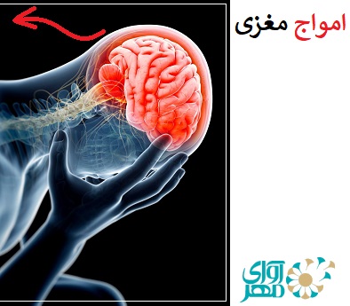 امواج مغزی