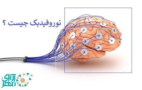 نورونوفیدبک چیست